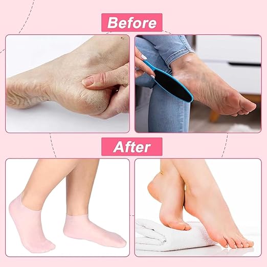 Silicone Moisturizing Gel Socks Set for dry Skin (1 Pair) socks for women